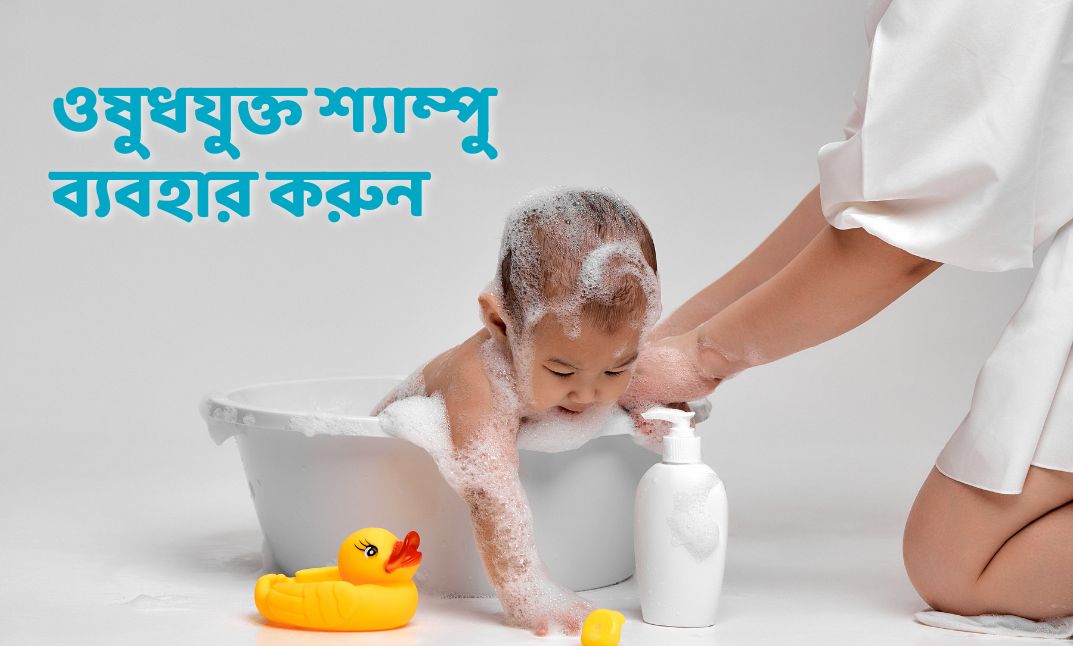 ওষুধযুক্ত শ্যাম্পু ব্যবহার করুন