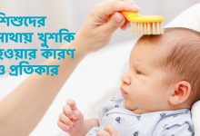 শিশুদের মাথায় খুশকি হওয়ার কারণ ও প্রতিকার