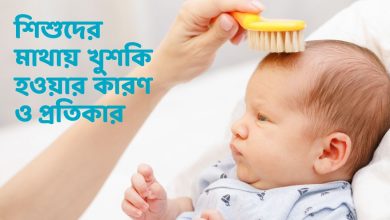 শিশুদের মাথায় খুশকি হওয়ার কারণ ও প্রতিকার